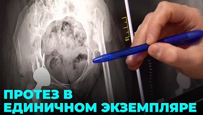 Новосибирские хирурги спасли девушку с редким диагнозом