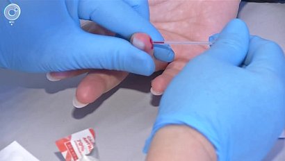 Число пациентов с гепатитом в Новосибирской области превышает общероссийские показатели