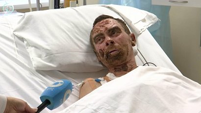 Врачи-комбустиологи спасают жизни: как эвакуация помогает пострадавшим с ожогами