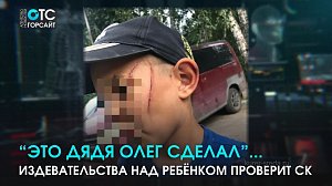 "Это дядя Олег сделал": историей избиения ребёнка заинтересовались в следственном комитете